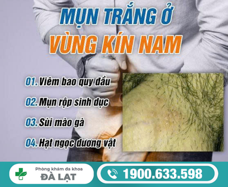 Hình ảnh minh họa